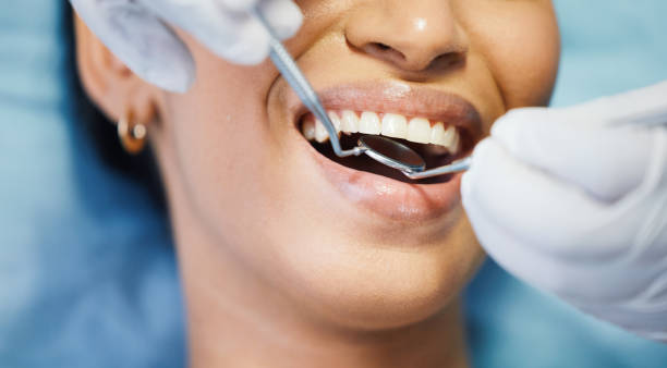 Best Broken or Cracked Tooth Emergency Dentist in Longview Heights, WA