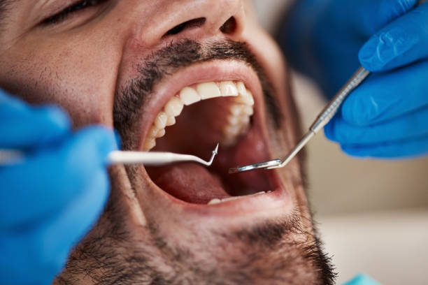 Best Emergency Dentist for Knocked-Out Tooth in Longview Heights, WA