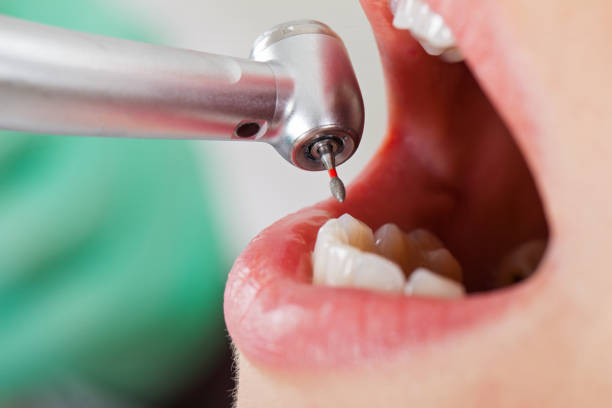 Best Pediatric Emergency Dentist in Longview Heights, WA